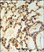 IMMP2L Antibody in Immunohistochemistry (Paraffin) (IHC (P))