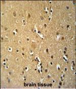 CD30 Antibody in Immunohistochemistry (Paraffin) (IHC (P))