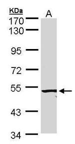 ACVRL1 Antibody in Western Blot (WB)