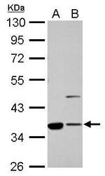 Annexin A2 Antibody in Western Blot (WB)