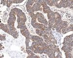 Survivin Antibody in Immunohistochemistry (Paraffin) (IHC (P))