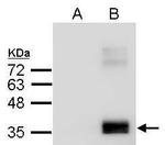 APOE Antibody in Western Blot (WB)