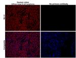 Bcl-2 Antibody in Immunohistochemistry (Paraffin) (IHC (P))