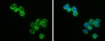 Bcl-2 Antibody in Immunocytochemistry (ICC/IF)