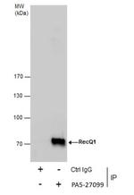 RecQ1 Antibody in Immunoprecipitation (IP)