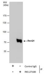 RECQ1 Antibody in Immunoprecipitation (IP)