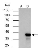 XLF Antibody in Immunoprecipitation (IP)