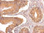 TIP30 Antibody in Immunohistochemistry (Paraffin) (IHC (P))