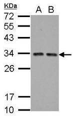 TIP30 Antibody in Western Blot (WB)