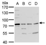 TDP1 Antibody in Western Blot (WB)