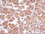 Calcium Channel beta-4 Antibody in Immunohistochemistry (Paraffin) (IHC (P))