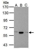 Calcium Channel beta-4 Antibody in Western Blot (WB)