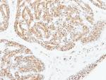 ATF2 Antibody in Immunohistochemistry (Paraffin) (IHC (P))