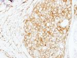 Cortactin Antibody in Immunohistochemistry (Paraffin) (IHC (P))