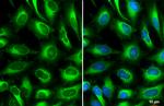 ACSL4 Antibody in Immunocytochemistry (ICC/IF)