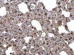 ACSL4 Antibody in Immunohistochemistry (Paraffin) (IHC (P))