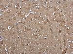 ACSL4 Antibody in Immunohistochemistry (Paraffin) (IHC (P))