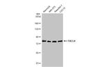 ACSL4 Antibody in Western Blot (WB)