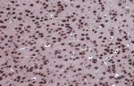 FOXO3A Antibody in Immunohistochemistry (Paraffin) (IHC (P))