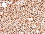 FOXO3A Antibody in Immunohistochemistry (Paraffin) (IHC (P))