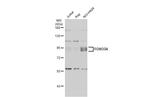 FOXO3A Antibody in Western Blot (WB)