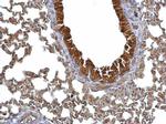 14-3-3 sigma Antibody in Immunohistochemistry (Paraffin) (IHC (P))