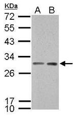 14-3-3 sigma Antibody in Western Blot (WB)