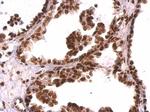 GRB2 Antibody in Immunohistochemistry (Paraffin) (IHC (P))