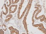 ERAB Antibody in Immunohistochemistry (Paraffin) (IHC (P))