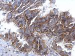 CCR3 Antibody in Immunohistochemistry (Paraffin) (IHC (P))