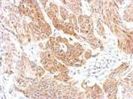 CXCR6 Antibody in Immunohistochemistry (Paraffin) (IHC (P))