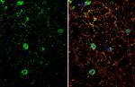 DRD1 Antibody in Immunocytochemistry (ICC/IF)