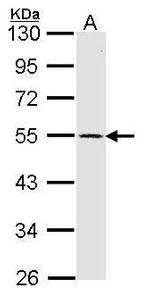 DRD1 Antibody in Western Blot (WB)