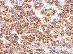 CXCR1 Antibody in Immunohistochemistry (Paraffin) (IHC (P))