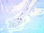 p27 Kip1 Antibody in Immunohistochemistry (Paraffin) (IHC (P))