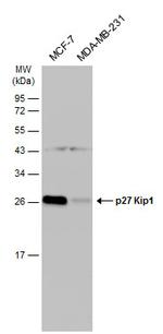 p27 Kip1 Antibody in Western Blot (WB)