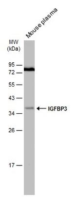 IGFBP3 Antibody in Western Blot (WB)