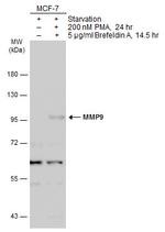 MMP9 Antibody in Western Blot (WB)