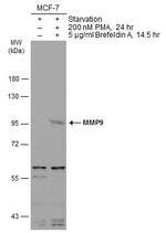 MMP9 Antibody in Western Blot (WB)