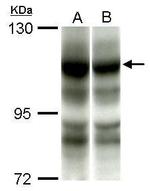 PIK3CA Antibody in Western Blot (WB)