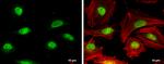 RAD51 Antibody in Immunocytochemistry (ICC/IF)