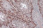 RAD51 Antibody in Immunohistochemistry (Paraffin) (IHC (P))