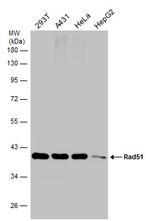 RAD51 Antibody in Western Blot (WB)