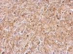 Maspin Antibody in Immunohistochemistry (Paraffin) (IHC (P))