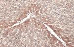 ABAT Antibody in Immunohistochemistry (Paraffin) (IHC (P))