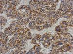 ACADL Antibody in Immunohistochemistry (Paraffin) (IHC (P))