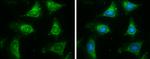 ACADM Antibody in Immunocytochemistry (ICC/IF)