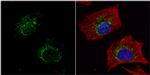 ACADM Antibody in Immunocytochemistry (ICC/IF)