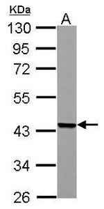 ACADM Antibody in Western Blot (WB)