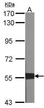 XIAP Antibody in Western Blot (WB)